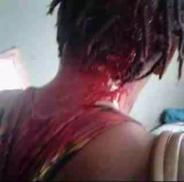 Domestic Violence: Nigerian Man Breaks His Wife’s Head [Graphic Photos]